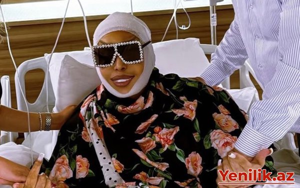 74 yaşlı Bülent Ersoy üzgərmə əməliyyatı etdirdi - Foto