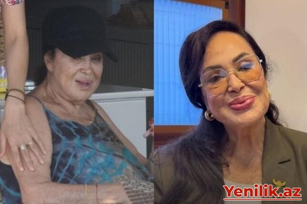81 yaşlı Türkan Şoray çimərlikdə – FOTOLAR