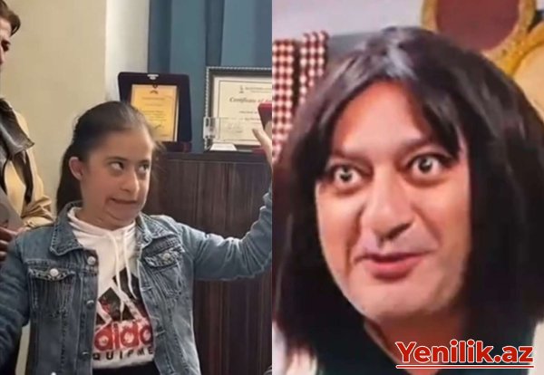 
Autizmli uşağı parodiya edən aktyor tənqid olundu: “Bilərəkdən olmayıb”